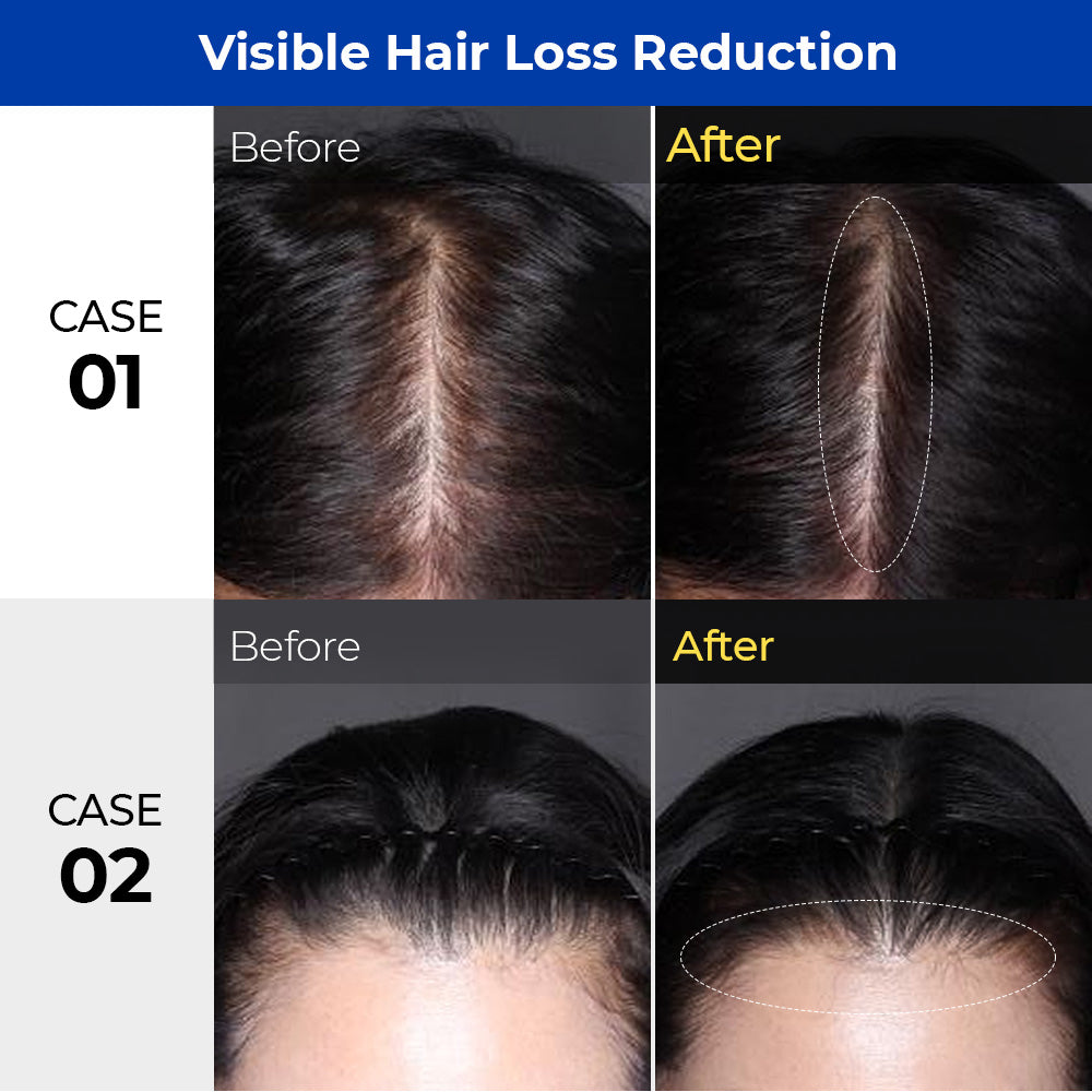 DR.BANGGIWON Lab Shampoo for Anti-Hair Loss 1000ml