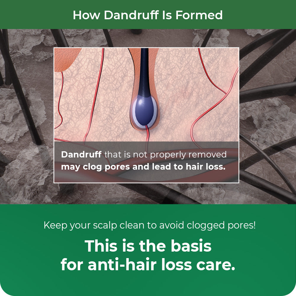 DR.BANGGIWON Dandruff Shampoo for Anti-Hair Loss 1000ml