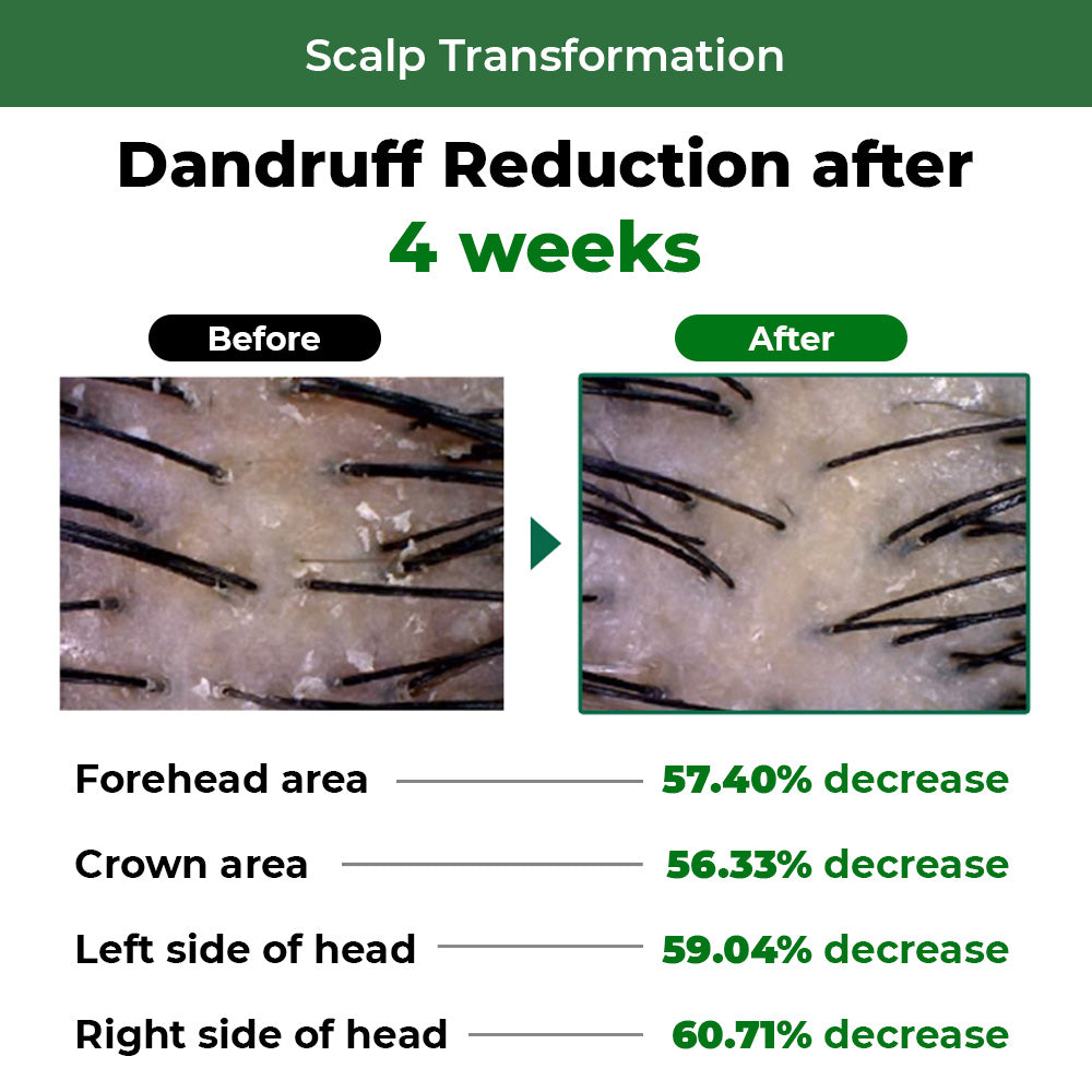 DR.BANGGIWON Dandruff Shampoo for Anti-Hair Loss 1000ml