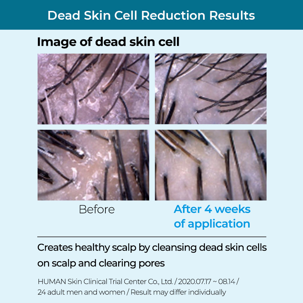 DR.BANGGIWON Cool Shampoo for Anti-Hair Loss 1000ml