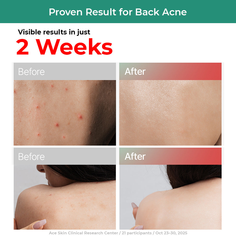 DR.BANGGIWON Acne Care Skin Alleviating Functional Body Wash 1000ml