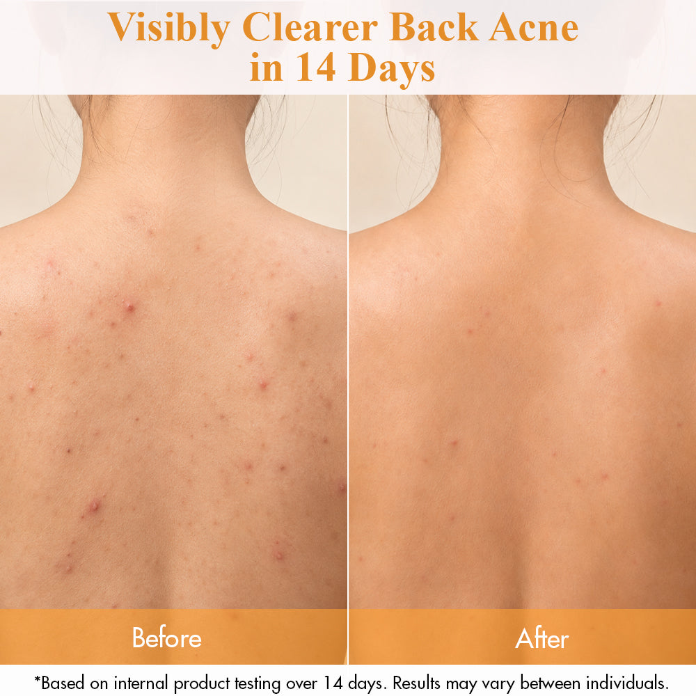 THE CLEAN DERMA Clarifying Active Derma Body Wash 500ml