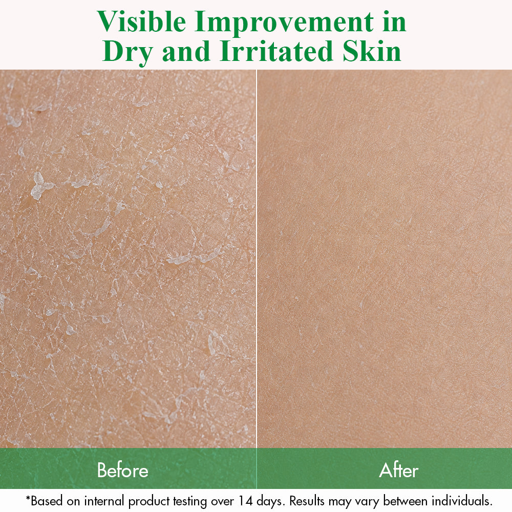 THE CLEAN DERMA Sensitive Relief Active Derma Body Wash 500ml